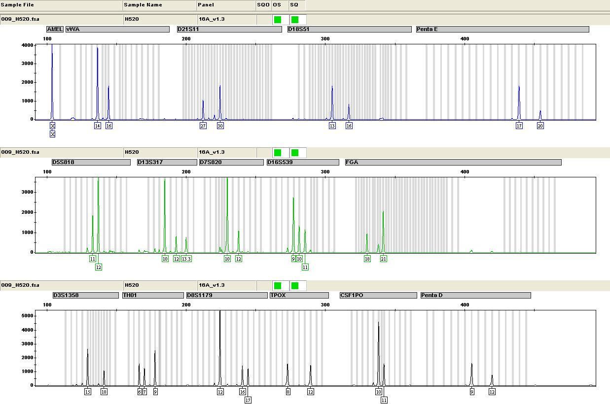 亲子鉴定检测流程之数据分析DNA图谱